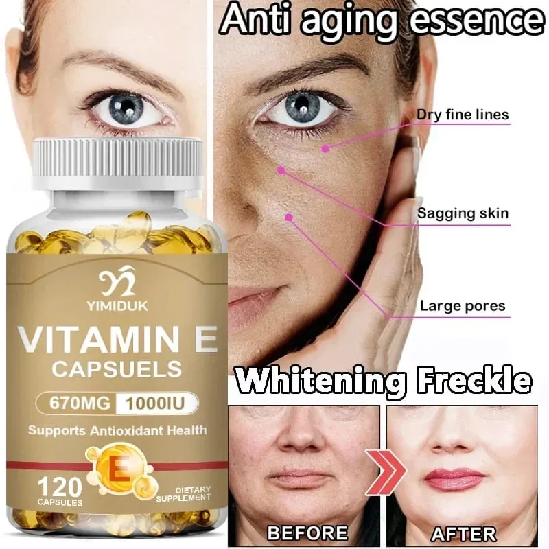 Buy 1 Get 1 Free! Vitamin E 670mg Capsules Support Skin & Heart Health Moisturizes from Within Reduces Scars & Promotes Shine