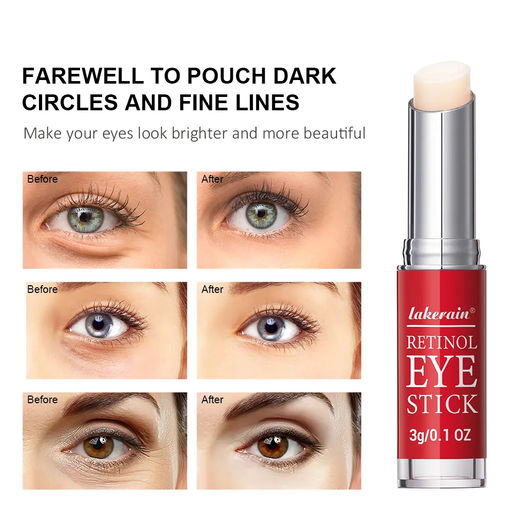Anti-Wrinkle Eye Cream Retinol Remove Eye Bags Dark Circles Anti Aging Lifting Whitening Moisturizing Brighten Eye Primer — image 7