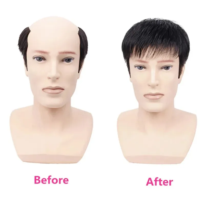 Male Clip-On Short Hair Wig Head Top Replacement Blocks Effectively Covering with Surrounding Hair Replacement Synthetic Hair