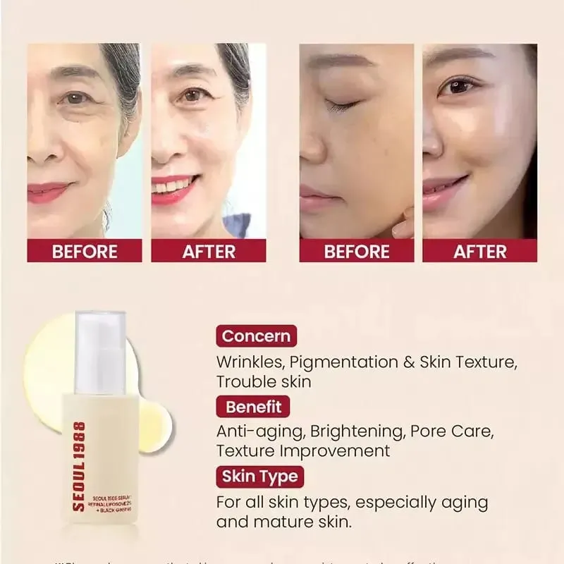 1988 Serum : Retinal Liposome 2% + Black Gingeng 30ml/1.01fl.oz | 58% Black Gingeng Extract with Retinal Bakuchiol Vita