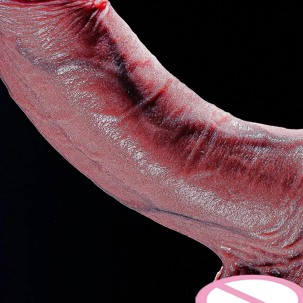 ขนาดใหญ่หนาDildoจริงDildosเส้นผ่านศูนย์กลางเส้นรอบวงDildoสำหรับAnal G-Spotกระตุ้นBody-Safe Big Analของเล่นพร้อมถ้วยดูดยักษ์ — image 1