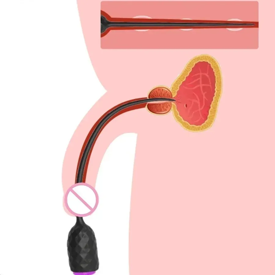 Long Urethral Catheter Vibrator Penis Plug Vibrating Urethra Sound Dilator Prostate Massager Male Masturbator Sex Toys For Men — image 3