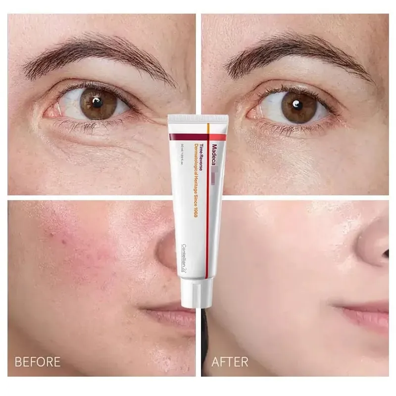Collagen Madeca Cream Time Reverse Advanced Fast-Absorbing Nourishing Hydrates Firms Reduces Wrinkles Korean Skin Care Centella
