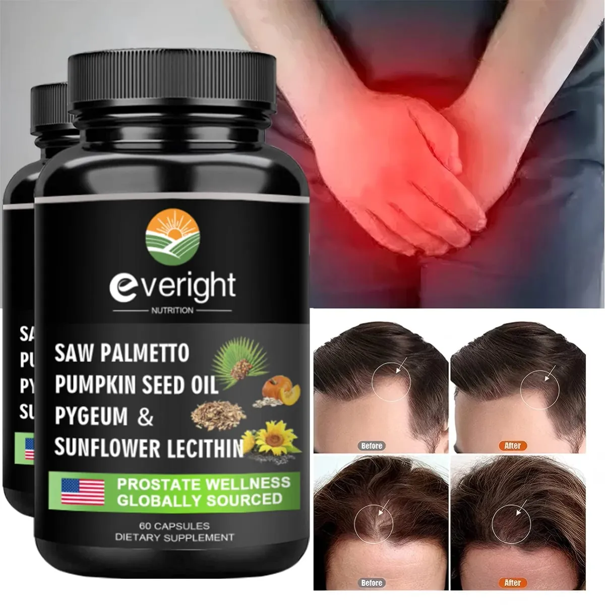 Saw Palmetto Capsules - Prostate Support Hair Loss Defense & Hormone Balance — image 3